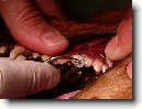 Stomatologie - zubn� v�pln�